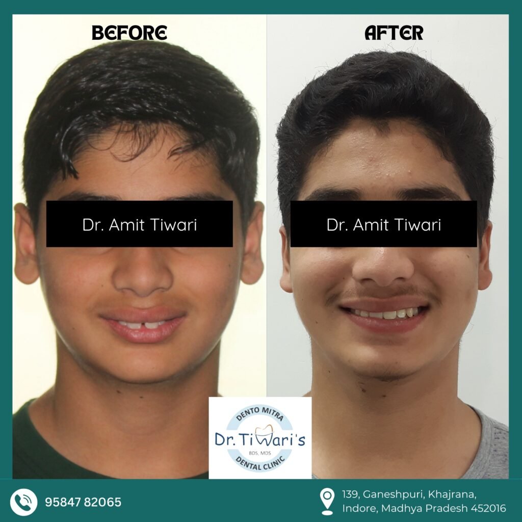 CASE-007 Smile and Facial Appearance Comparison